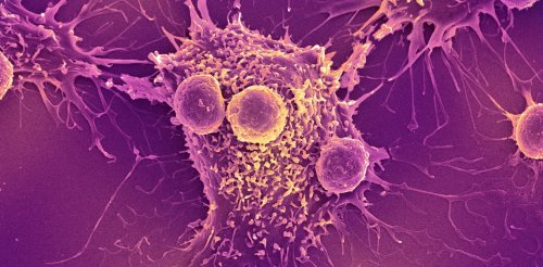 COVID-19 vaccines could unlock the next revolution in cancer treatment 
