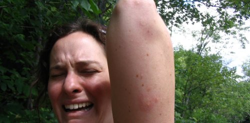 Health Check: why mosquitoes seem to bite some people more
