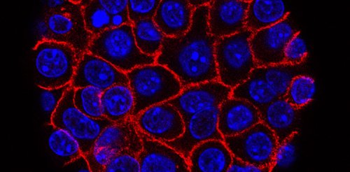 Triggering cancer cells to become normal cells – how stem cell therapies can provide new ways to stop tumors from spreading or growing back