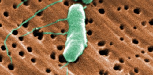Flesh-eating bacteria infections are on the rise in the US − a microbiologist explains how to protect yourself