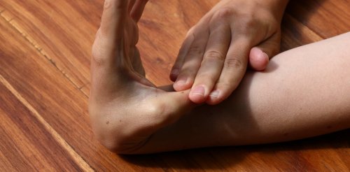 Bendy joints, stretchy skin, clumsiness. Why hypermobile Ehlers-Danlos Syndrome is often missed – and what it has to do with autism