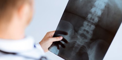 Que montre vraiment l’imagerie médicale en cas de mal de dos ?