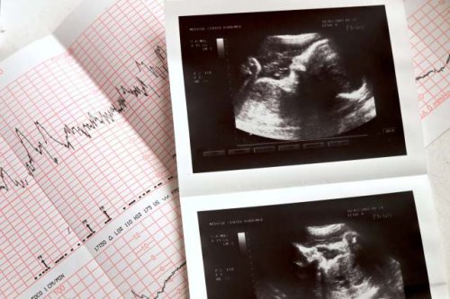 Scientists make disturbing new discovery about fetal brain development: 'This is your brain on ozone'