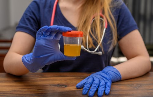 Researchers make groundbreaking discovery about potential uses of human urine: 'A crucial input'