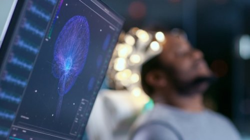 Scientists issue warning after uncovering escalating threat to brain health — here's what they found