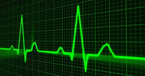 Canadian researchers develop radar system for monitoring vital signs