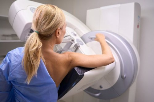 Don’t Skip Your Screenings: A Doctor Shares What to Know About Pre-Cancer