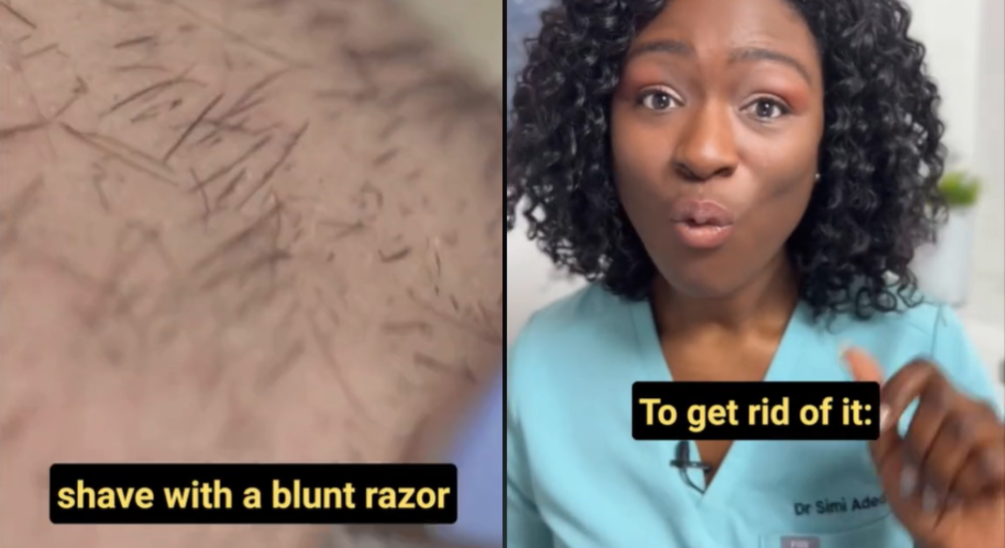 Doctor's tip to treat and prevent razor burn to level up your shower routine