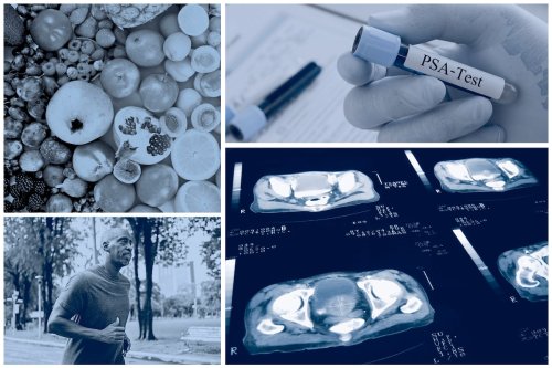 When and how should I be screened for prostate cancer?