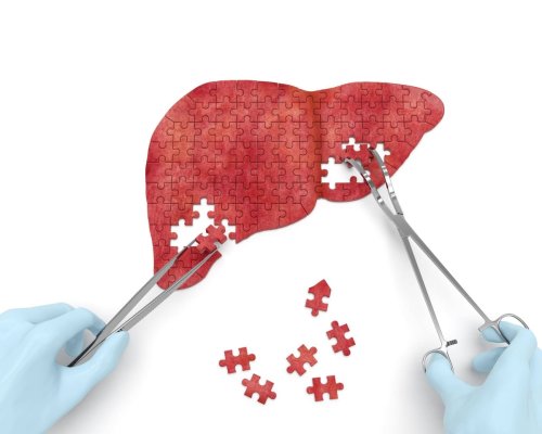 Is your liver too fat? Time to put it on a diet