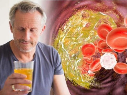High Cholesterol Lowering Diet: Top 7 Superfoods To Control Bad LDL Cholesterol Levels Naturally In Men 40s