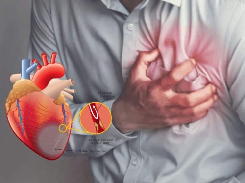 7 Warning Signs of a Stroke That Starts Appearing One Week Before Heart Fails Completely