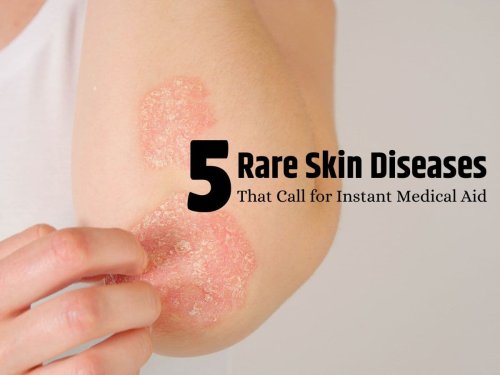 Don't Ignore These! 5 Rare Skin Conditions That Demand Urgent Medical Attention