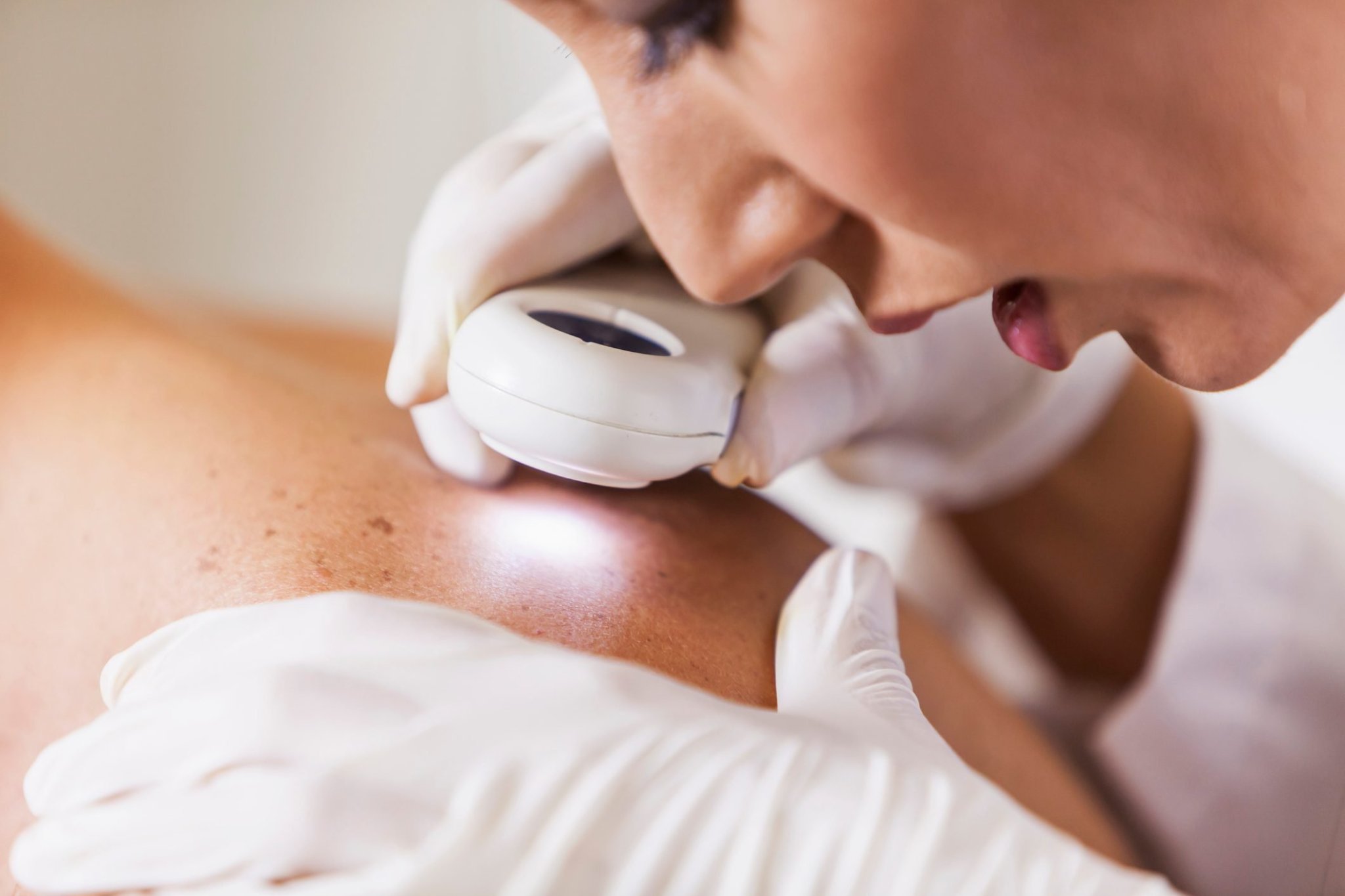 This Is What a Dermatologist First Notices About You