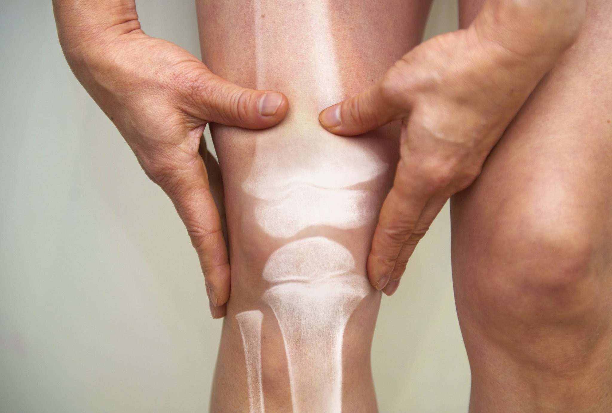 Want Healthy Joints and Cartilage? Make Sure You’re Doing These 8 Things