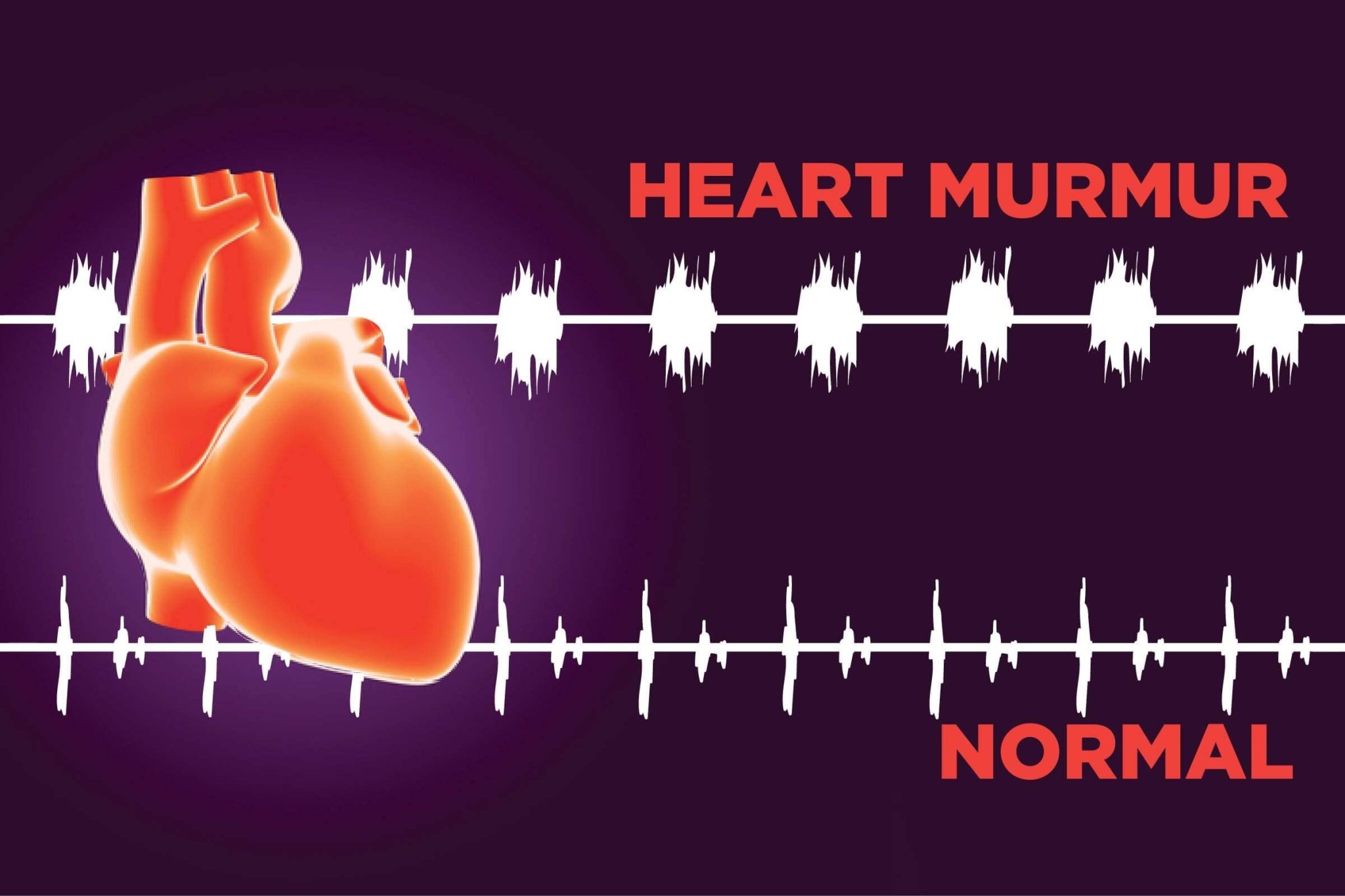 8 Silent Signs You May Have Heart Murmur