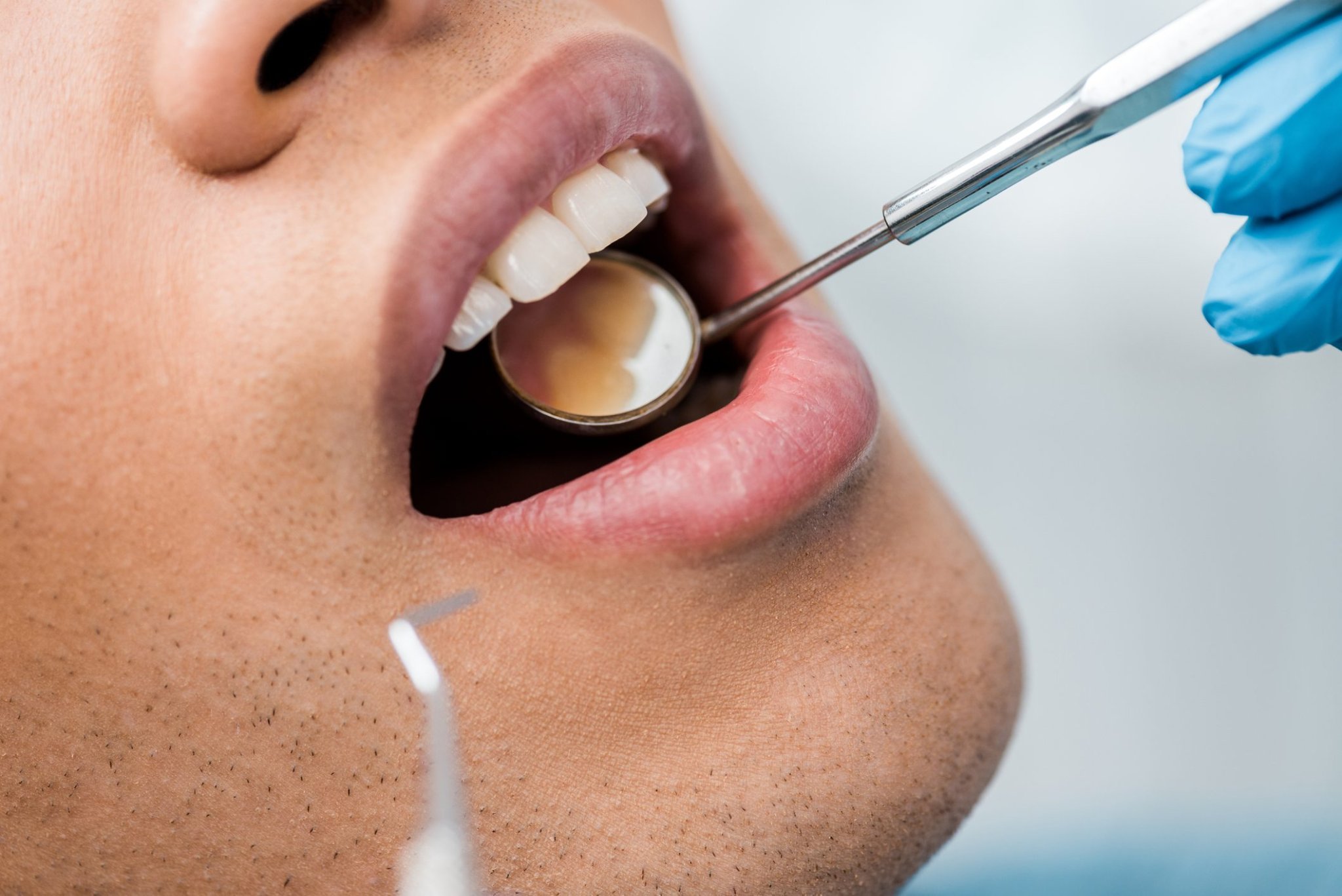 4 Ways Covid-19 Is Bad for Your Teeth, According to Dentists
