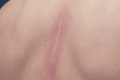 What Is Skin Writing? Everything You Need to Know