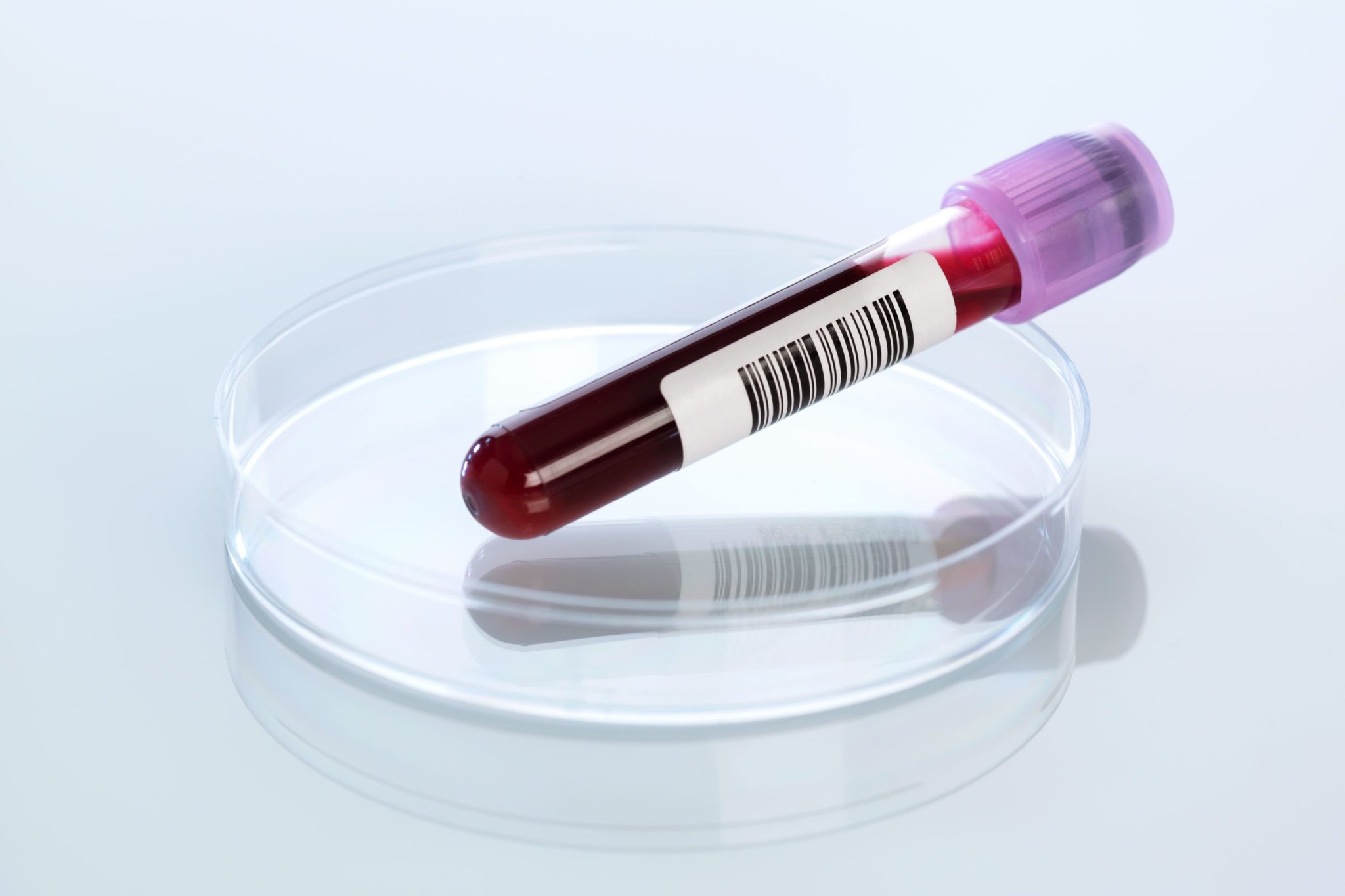 This Simple New Blood Test Can Detect Alzheimer’s Risk with 96% Accuracy