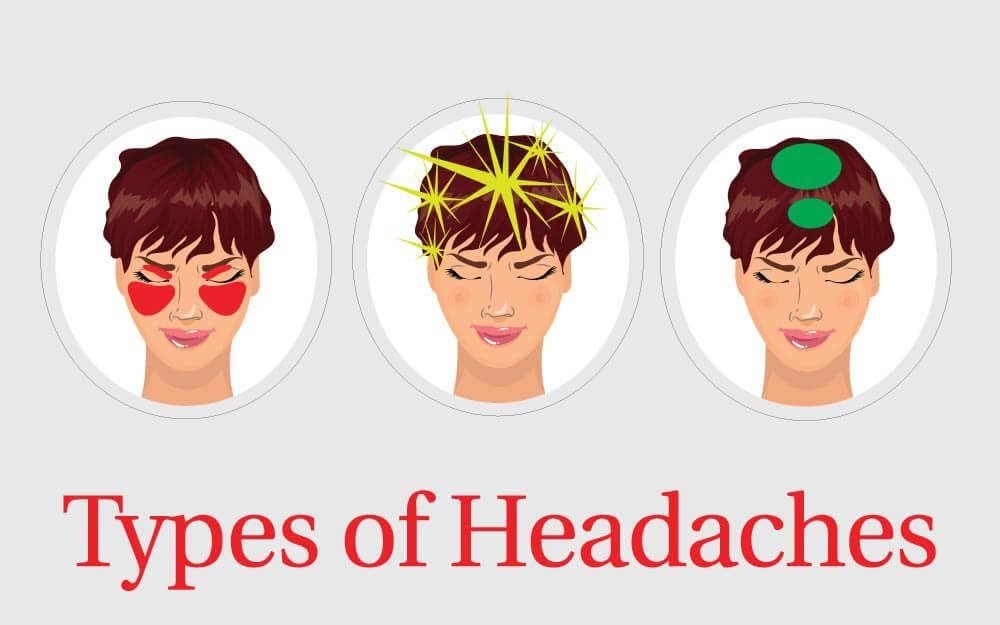 8 Types of Headaches—and How to Get Rid of Them