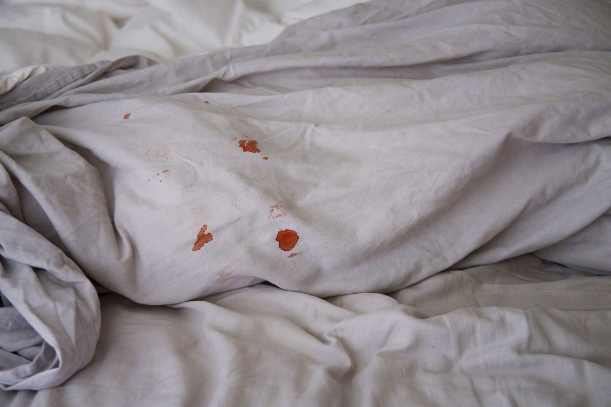 Is Bleeding After Sex Normal? 16 Things to Know