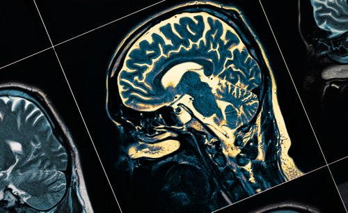 Scientists say they might have discovered the cause of Alzheimer's