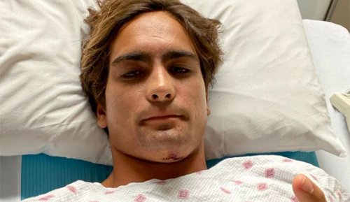 Eli Hanneman Lacerates Pancreas, Gets 16 Stitches in Head in Pipeline Wipeout