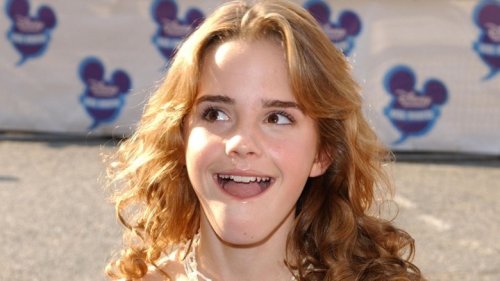 Emma Watson Didn't Always Look Like This