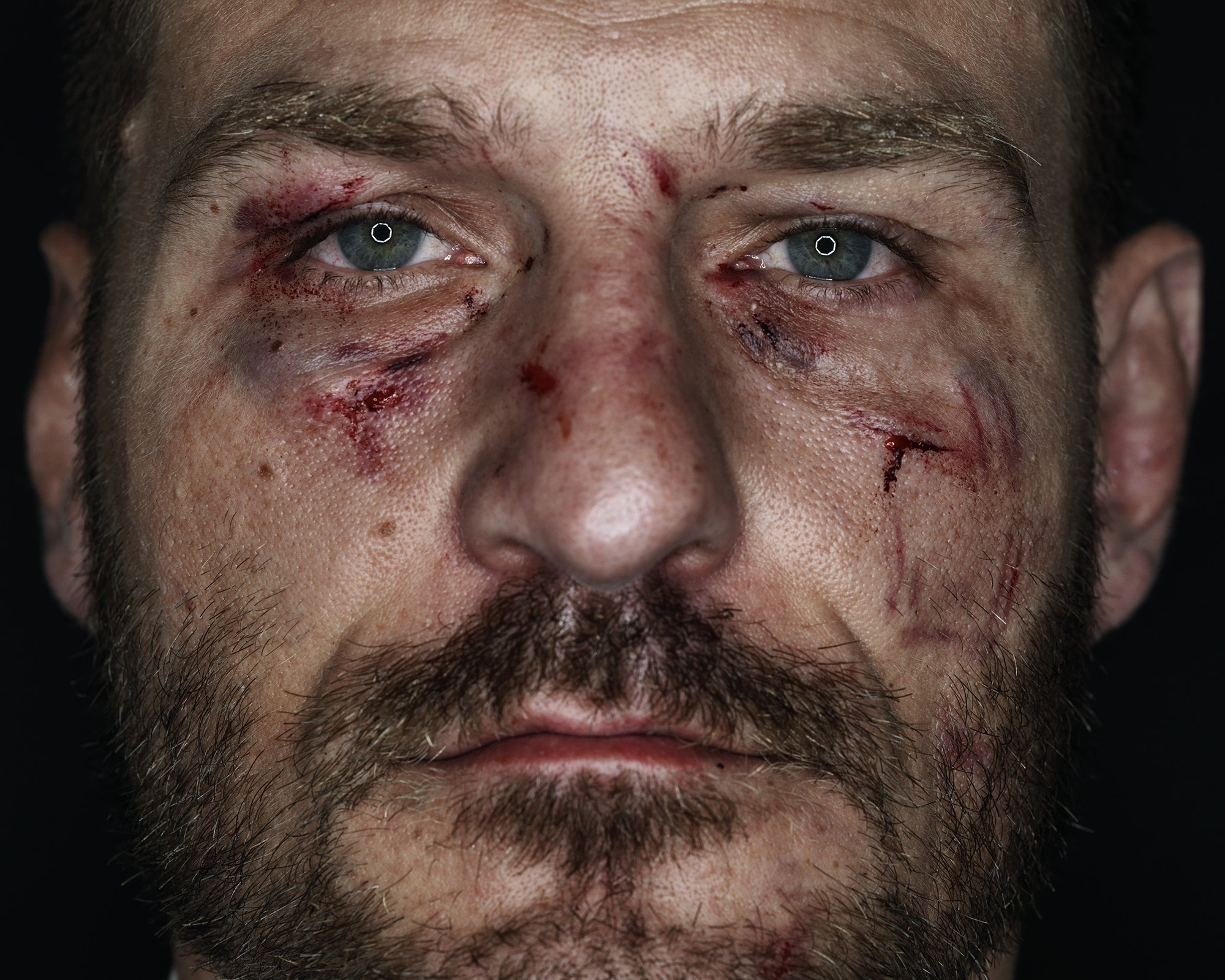 Kevin Lynch Portrays The Humanity Behind Fierce UFC Fighters