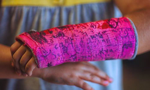 What is ‘trans broken arm syndrome’ and how can we help stop it?