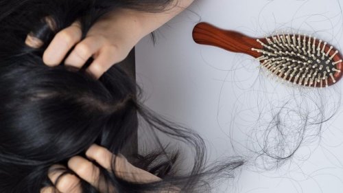 Hair Fall and Diet: Foods To Prevent Hair Loss