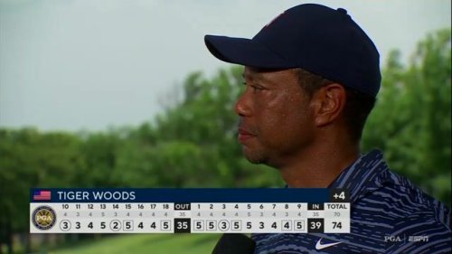 After limping on the 18th hole at the PGA, Tiger Woods says his leg has "felt better."
