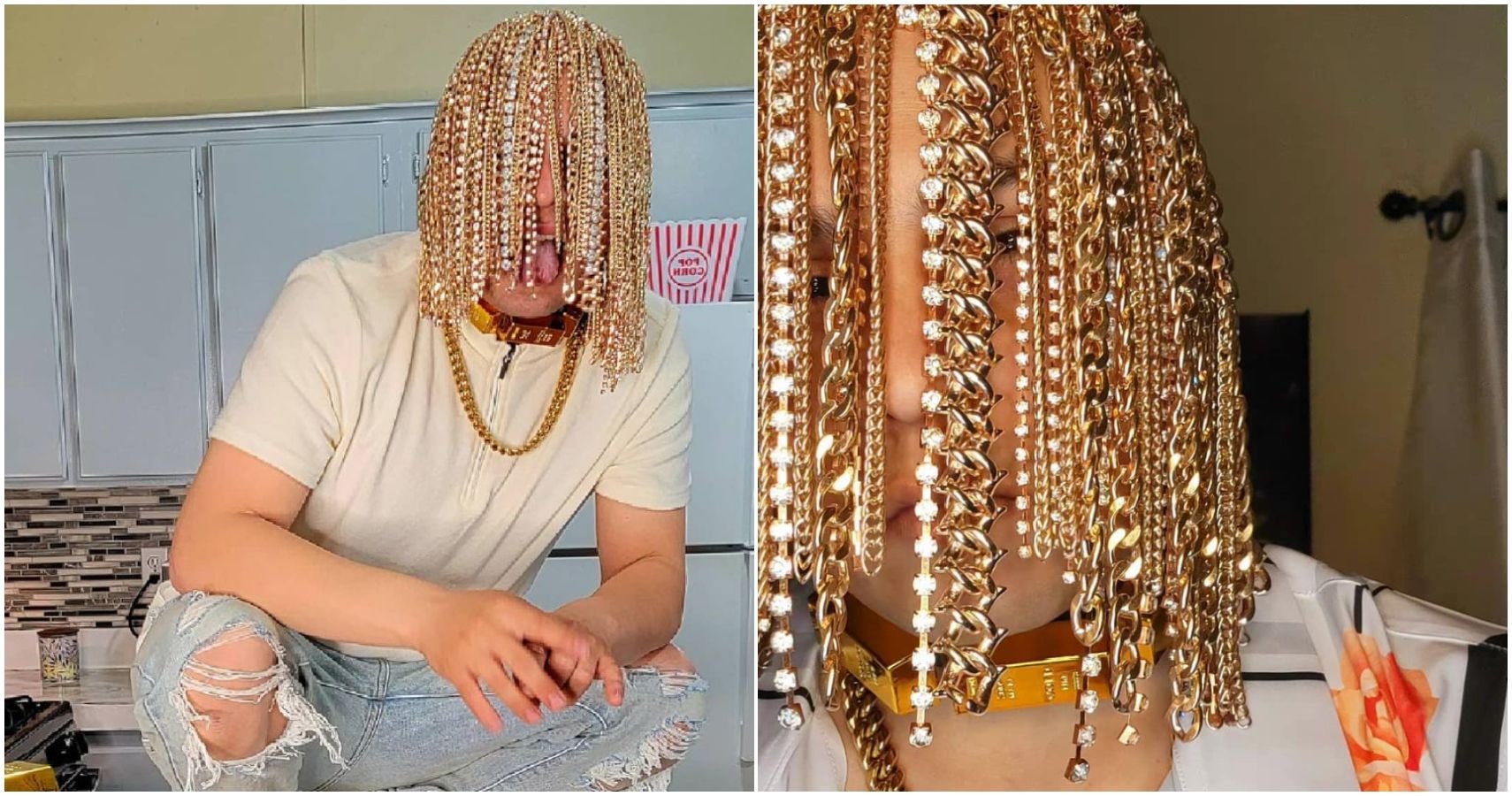 Gold Rush: Rapper Dan Sur Replaces Hair With Surgically Implanted Gold Chains