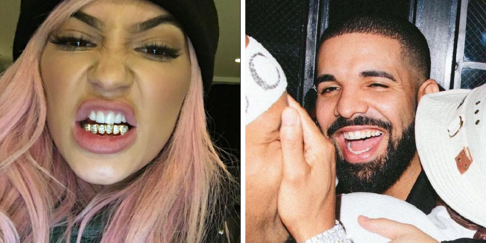Drake Has A Pink Diamond Tooth And 25 Other Celebs With Mouth Bling Worth More Than Our Car