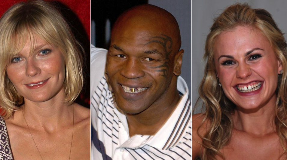 20 Celebrities With The Most Awful Looking Teeth