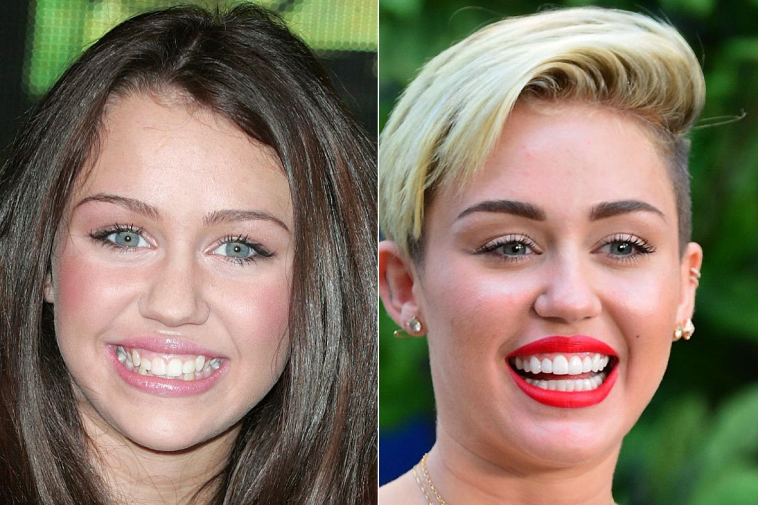 20 Hollywood Celebs You Didn’t Know Have Fake Teeth