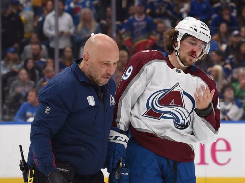 Avs' Girard out for playoffs after breaking sternum