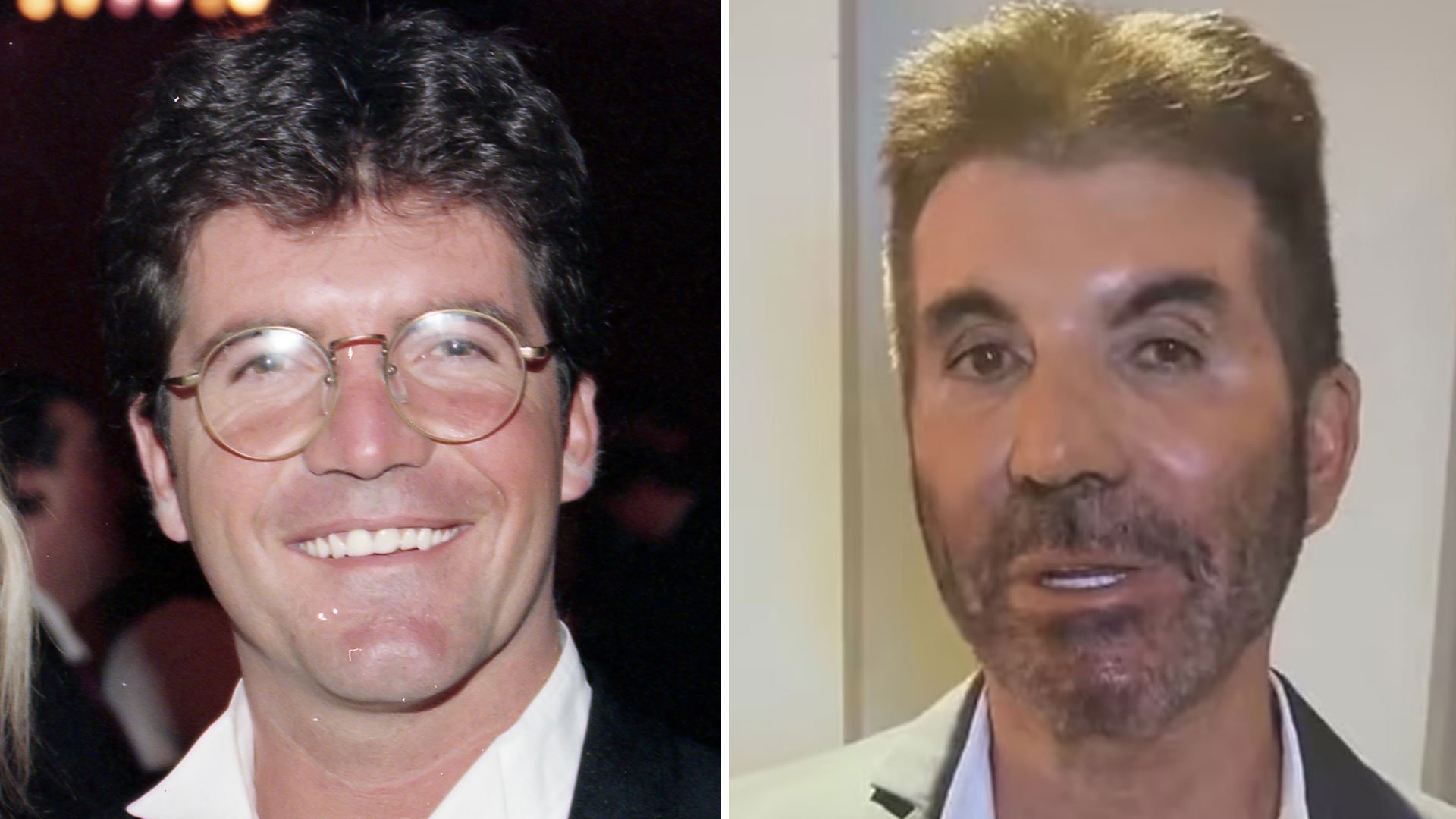 Simon Cowell's changed face over the years as a BGT star reveals a new