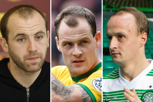 Footballers with hair transplants including Griffiths, McFadden and Stokes