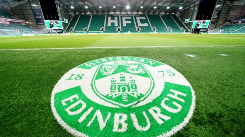 Eye-watering Hibs loss and huge wage to turnover ratio shown in latest figures