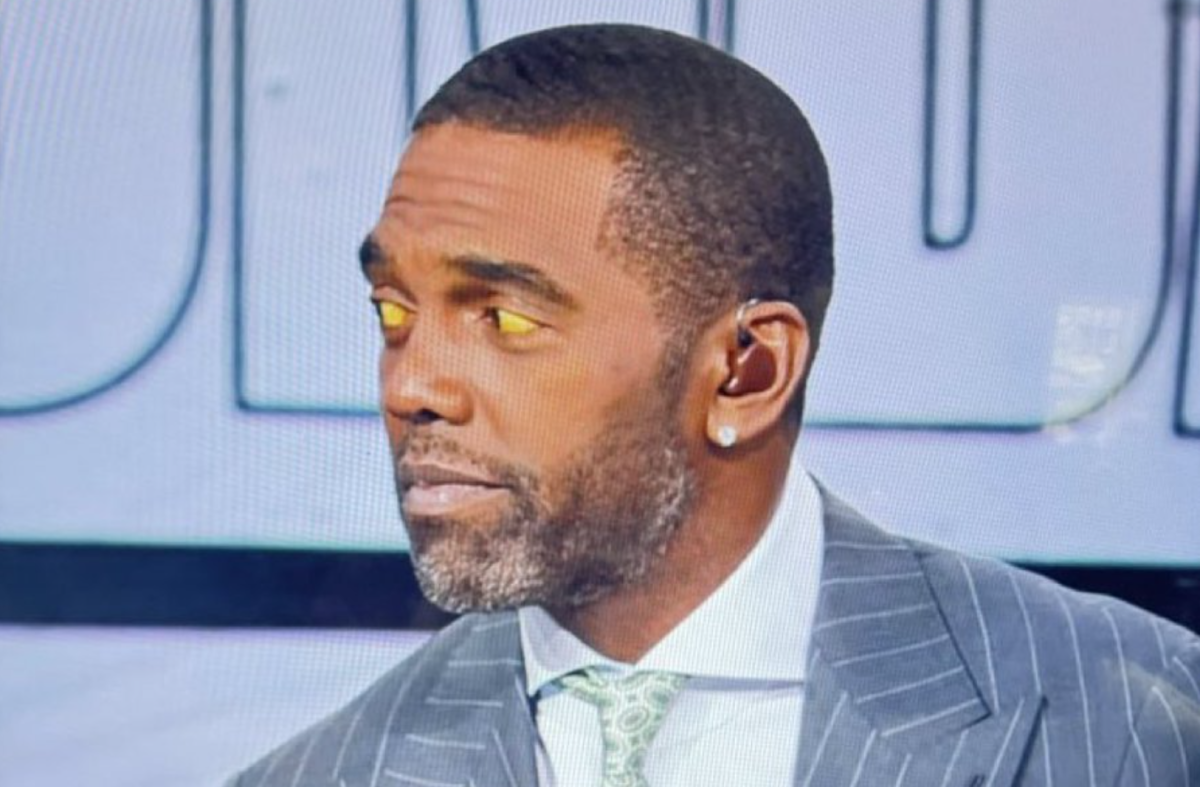 Doctor Reveals What Could Be Causing Randy Moss's Yellow Eyes Flipboard