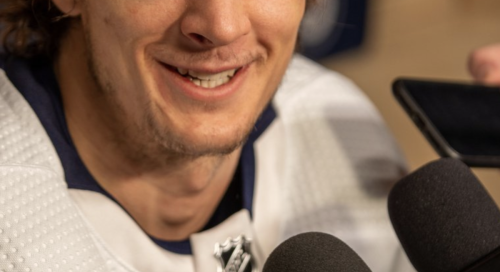 photo-shows-what-nhl-player-looks-like-after-75-stitches-to-face