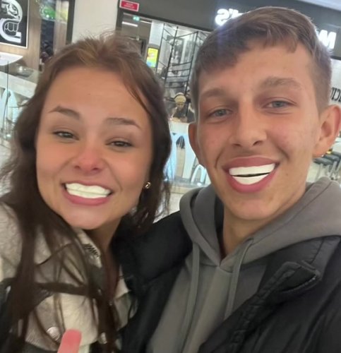 Man and his friend show off their new Turkey teeth at the airport – but things aren’t quite as they seem