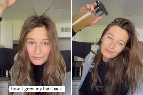 Woman shares cheap DIY spray that helped her hair grow back – and you probably own the ingredients already