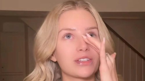 Lottie Moss reveals ‘new face’ in emotional TikTok video after having filler dissolved – and face tattoo removed