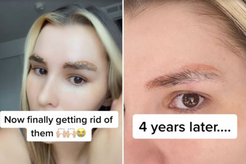 Woman urges others NOT to get eyebrows microbladed & shows results years later