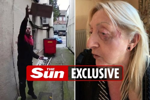 Delivery driver left me with black eye after throwing package over my fence