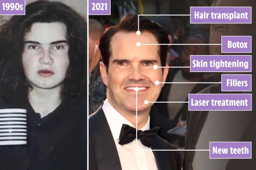 Jimmy Carr’s incredible face transformation as he says ‘little of the original is still there’ following midlife crisis