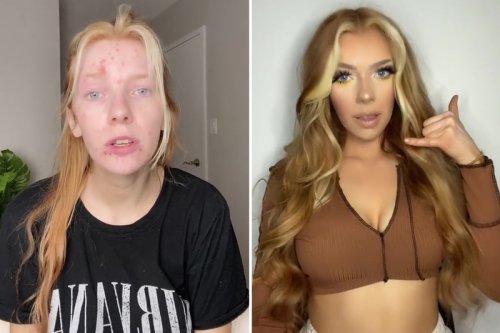 I'm pale with acne - but after layers of make-up & fake tan I catfish like a pro