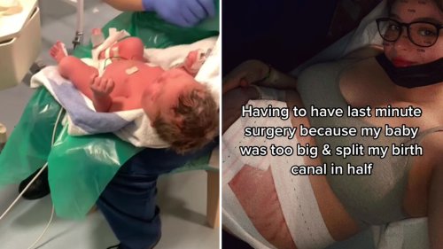 My baby was so big she SPLIT my birth canal in half – she was basically a toddler when he came out